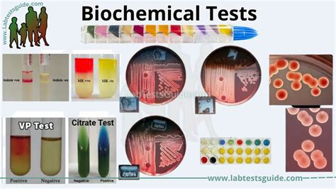 test biochimie|biochemistry lab tests pdf.